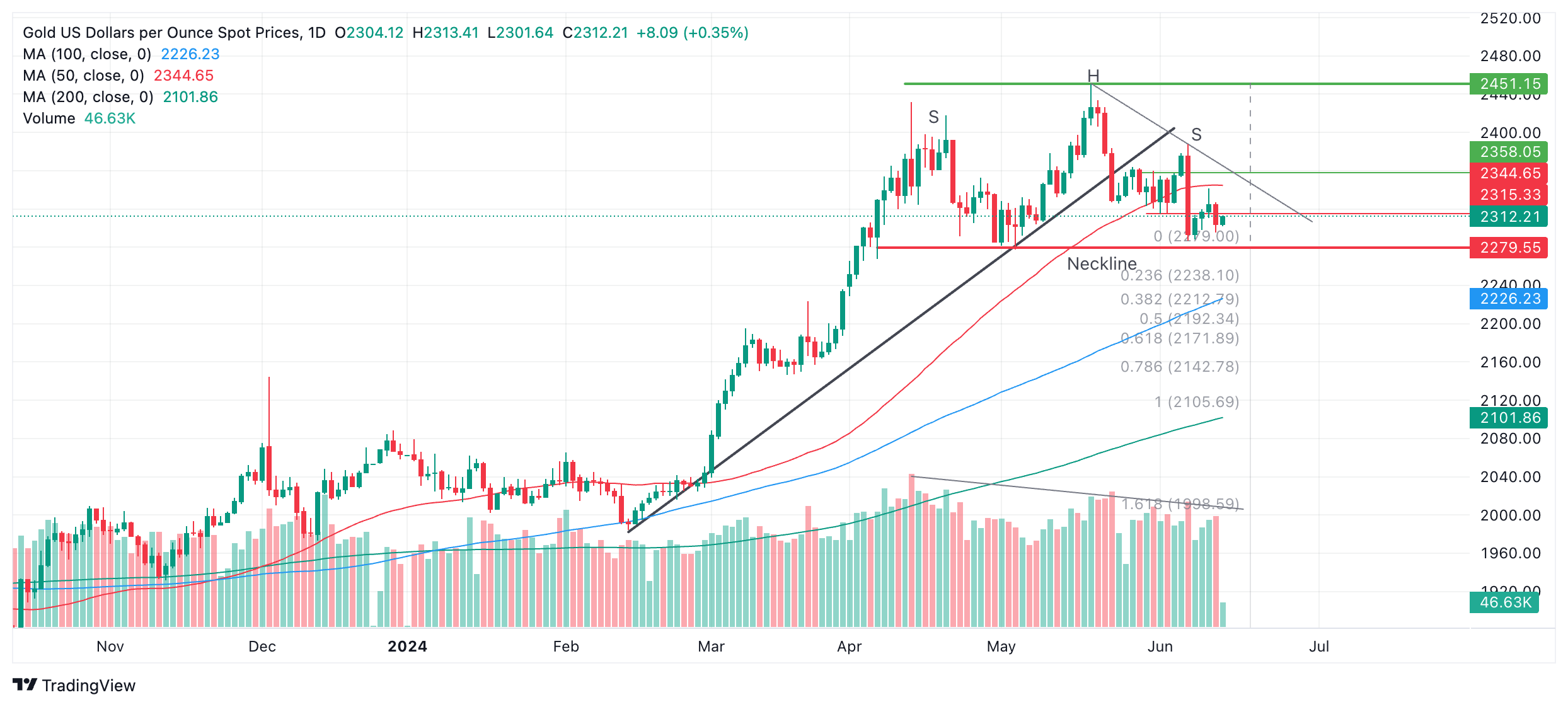 Gold trades in familiar territory amid mixed signals from US economy