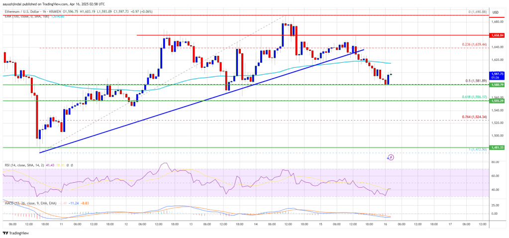 Ethereum Price  Dips Again—Time to Panic or Opportunity to Buy?